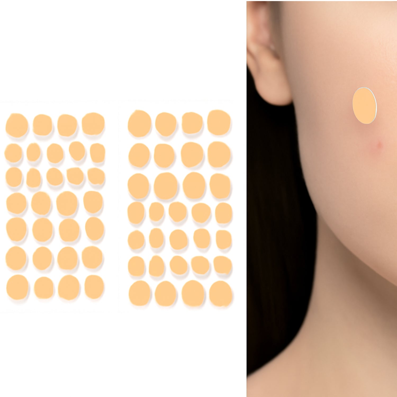 Pimple Patches for Face (2 Sheet Set) Pimple Patches for Face (2 Sheet Set)
